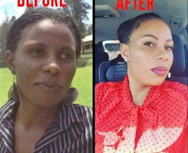 SKIN RUSHES, LIGHTENING AND CREANSING CREAM IN NEWCASTLE +27 81 850 2816